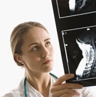 Az osteochondrosis diagnosztizálását egy x -try vizsgálat segítségével határozzuk meg