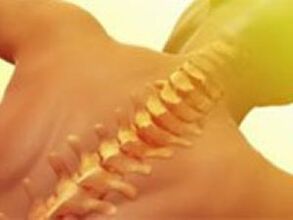 Osteochondrosis - gerincbetegség