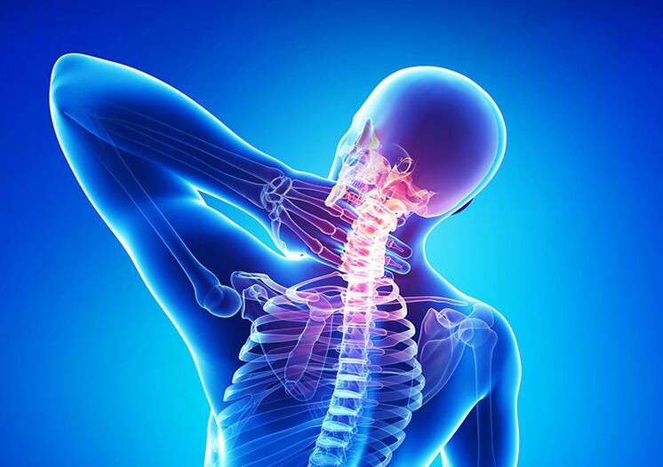 A gerinc osteochondrosis olyan betegség, amely az ízületi porcot és a csigolyákat érinti.