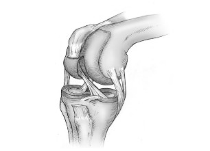 csípőízület artrózisának kondroprotektorjai a lábujjhártya hatékony kezelése