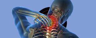 Nyaki osteochondrozist kezelő készítmények, A fájdalom mechanizmusa